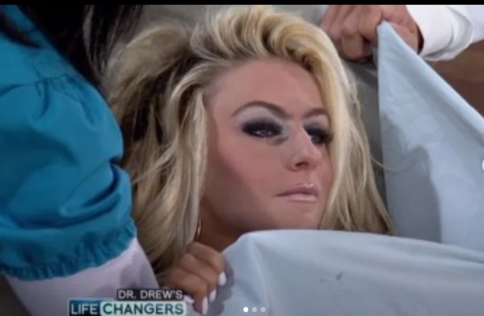 Courtney Stodden undergoes a breast exam on TV, with styled hair and dramatic makeup, partially covered by a blanket