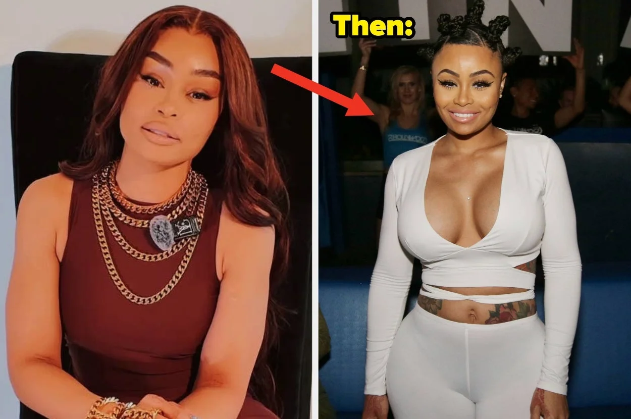 Blac Chyna Just Revealed Every Cosmetic Procedure She's Had — And The Ones She Hasn't
