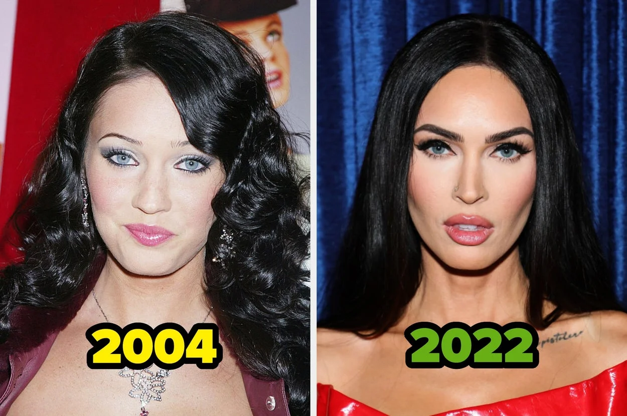 "Yeah, I'm Fully Bald... This Is Four Transplants": 20 Celebrities Who Got Shockingly Honest About All The Plastic Surgery Procedures They've Had